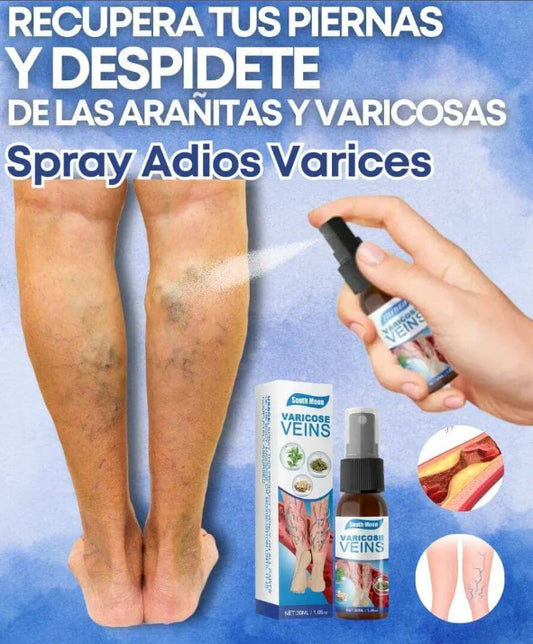 Treat Varicosveins